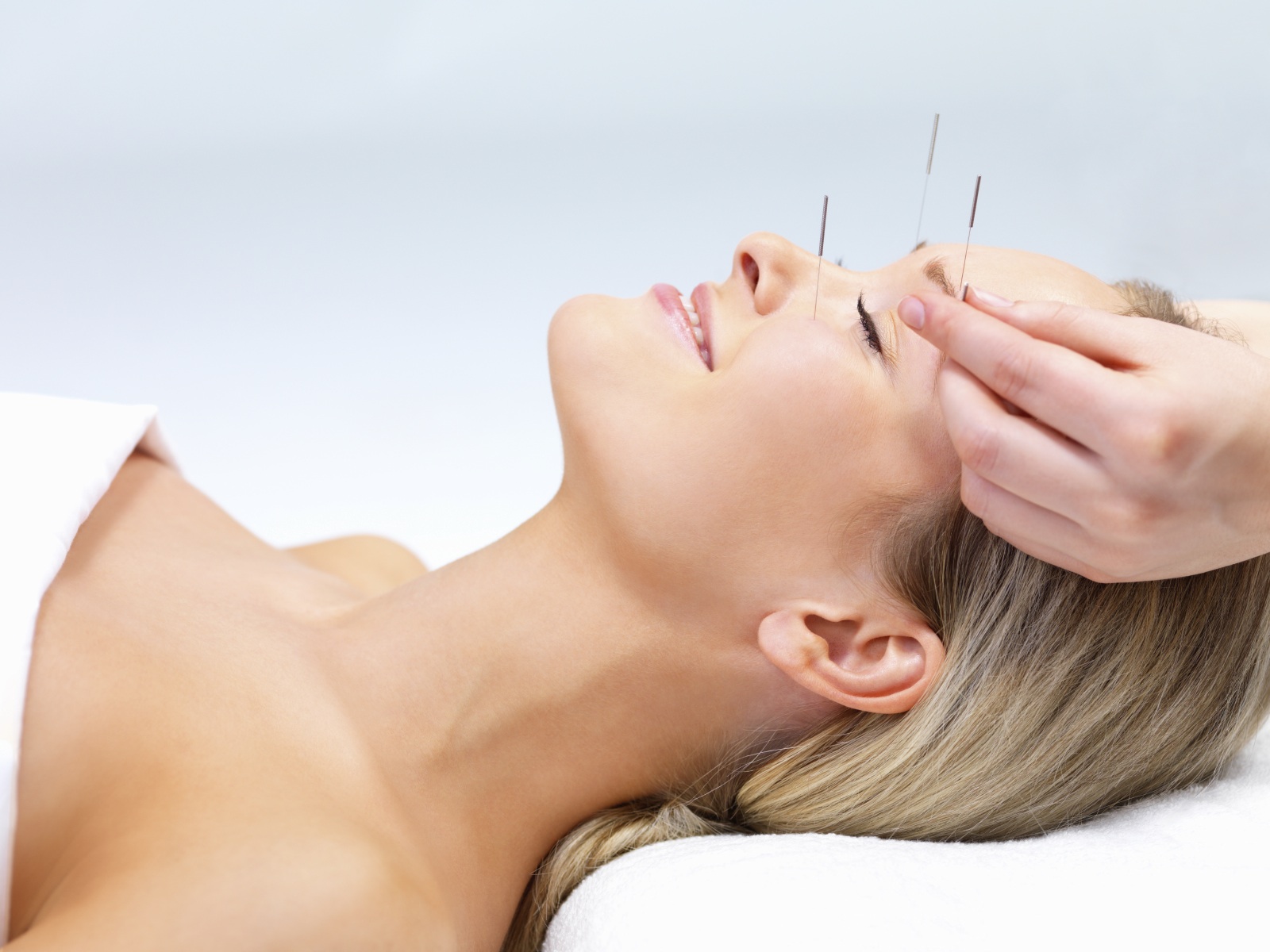 Acupuncture