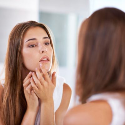 Top Tips For Combatting Acne