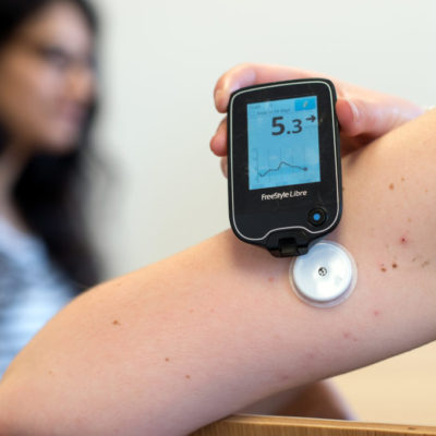 Features To Note Before You Use A Flash Glucose Monitor