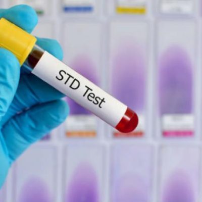 Learn How The Value Of Female STD Tests To Your Health